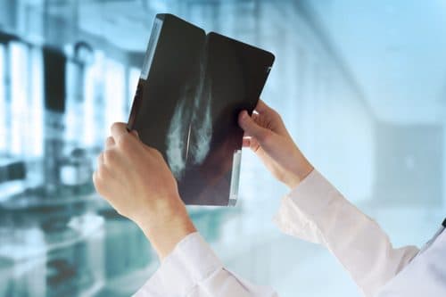 Doctor reviewing a mammogram